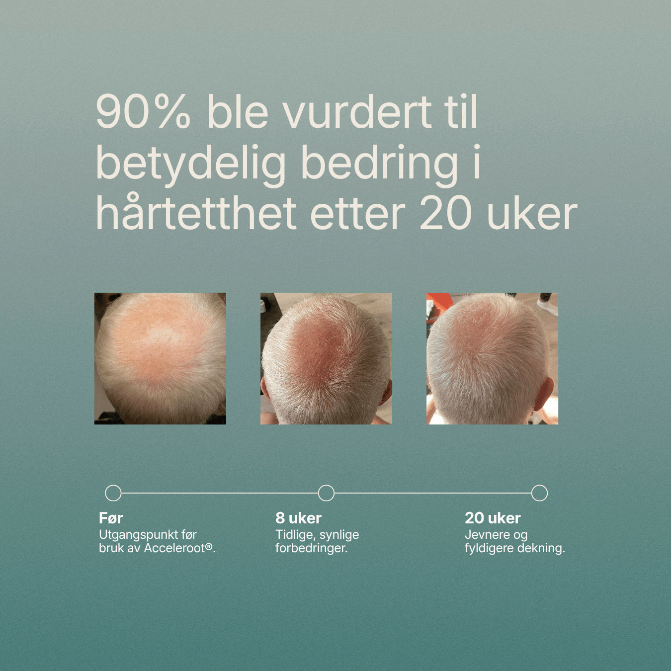 Acceleroot® Hair Growth Oil